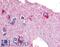 Glycogen Phosphorylase B antibody, LS-A2923, Lifespan Biosciences, Immunohistochemistry frozen image 