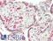 Iroquois Homeobox 2 antibody, LS-B14674, Lifespan Biosciences, Immunohistochemistry paraffin image 