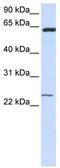 Transmembrane Protein 138 antibody, TA342013, Origene, Western Blot image 