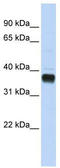 Nudix Hydrolase 18 antibody, TA346833, Origene, Western Blot image 