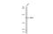 SMG6 Nonsense Mediated MRNA Decay Factor antibody, GTX131919, GeneTex, Western Blot image 