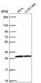 OVCA2 Serine Hydrolase Domain Containing antibody, HPA059002, Atlas Antibodies, Western Blot image 