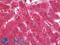 Complement C1s antibody, LS-B11015, Lifespan Biosciences, Immunohistochemistry paraffin image 