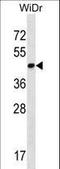 THAP Domain Containing 11 antibody, LS-C161845, Lifespan Biosciences, Western Blot image 