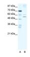 Inhibitor Of Nuclear Factor Kappa B Kinase Subunit Beta antibody, orb329633, Biorbyt, Western Blot image 