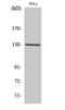 Serine/Threonine Kinase 10 antibody, A06406, Boster Biological Technology, Western Blot image 