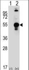 Chondromodulin antibody, LS-C98597, Lifespan Biosciences, Western Blot image 