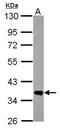 Fructosamine 3 Kinase antibody, NBP2-14959, Novus Biologicals, Western Blot image 