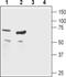 Cholinergic Receptor Nicotinic Beta 1 Subunit antibody, PA5-77507, Invitrogen Antibodies, Western Blot image 