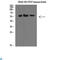 Selectin E antibody, LS-C813307, Lifespan Biosciences, Immunohistochemistry paraffin image 