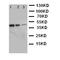 Erb-B2 Receptor Tyrosine Kinase 3 antibody, LS-C313025, Lifespan Biosciences, Western Blot image 