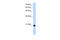 Ubiquitously Expressed Prefoldin Like Chaperone antibody, 30-334, ProSci, Western Blot image 