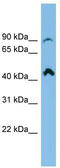 NEDD4 Binding Protein 2 Like 2 antibody, TA333590, Origene, Western Blot image 