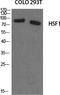 Heat Shock Transcription Factor 1 antibody, STJ93601, St John