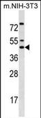 Iroquois Homeobox 5 antibody, PA5-71953, Invitrogen Antibodies, Western Blot image 