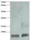 Cystatin-beta antibody, LS-C210971, Lifespan Biosciences, Western Blot image 