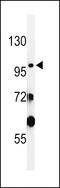 Inositol Polyphosphate-5-Phosphatase F antibody, 61-642, ProSci, Western Blot image 