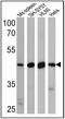 Beta-Secretase 2 antibody, PA1-753, Invitrogen Antibodies, Western Blot image 