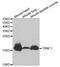 Troponin C1, Slow Skeletal And Cardiac Type antibody, A1927, ABclonal Technology, Western Blot image 