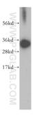 Heterogeneous nuclear ribonucleoprotein C antibody, 11760-1-AP, Proteintech Group, Western Blot image 