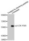 LCK Proto-Oncogene, Src Family Tyrosine Kinase antibody, MBS128376, MyBioSource, Western Blot image 