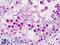 Scm Polycomb Group Protein Like 1 antibody, LS-B4414, Lifespan Biosciences, Immunohistochemistry paraffin image 