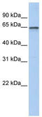 Adenosylhomocysteinase Like 1 antibody, TA332030, Origene, Western Blot image 