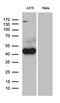Pleckstrin Homology Like Domain Family A Member 1 antibody, M05823, Boster Biological Technology, Western Blot image 