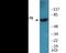 Zeta Chain Of T Cell Receptor Associated Protein Kinase 70 antibody, EKC2137, Boster Biological Technology, Western Blot image 