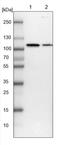 TBC1 Domain Containing Kinase antibody, NBP1-83166, Novus Biologicals, Western Blot image 