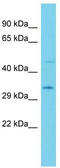 Acyl-CoA Binding Domain Containing 6 antibody, TA342937, Origene, Western Blot image 