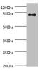 GLGB antibody, LS-C675797, Lifespan Biosciences, Western Blot image 