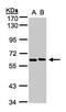 5'-Nucleotidase, Cytosolic II antibody, PA5-21688, Invitrogen Antibodies, Western Blot image 