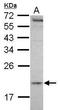 MCTS1 Re-Initiation And Release Factor antibody, PA5-31020, Invitrogen Antibodies, Western Blot image 