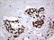 Heterogeneous Nuclear Ribonucleoprotein M antibody, LS-C338667, Lifespan Biosciences, Immunohistochemistry paraffin image 