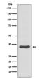 Cell Division Cycle Associated 5 antibody, M05043, Boster Biological Technology, Western Blot image 