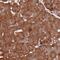 Component Of Oligomeric Golgi Complex 4 antibody, PA5-60016, Invitrogen Antibodies, Immunohistochemistry paraffin image 