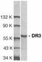 TNF Receptor Superfamily Member 25 antibody, GTX74225, GeneTex, Western Blot image 