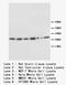 Sodium Voltage-Gated Channel Beta Subunit 1 antibody, LS-B11647, Lifespan Biosciences, Western Blot image 