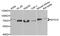 Integrator Complex Subunit 10 antibody, A6632, ABclonal Technology, Western Blot image 