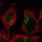 Transmembrane Protein 104 antibody, HPA044330, Atlas Antibodies, Immunofluorescence image 