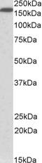 Neurofascin antibody, EB10984, Everest Biotech, Western Blot image 