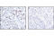 Chromobox 5 antibody, 2623S, Cell Signaling Technology, Immunohistochemistry paraffin image 