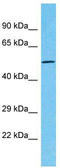 Tetratricopeptide Repeat Domain 39C antibody, TA330808, Origene, Western Blot image 
