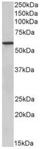 Epoxide Hydrolase 2 antibody, AP33492PU-N, Origene, Western Blot image 