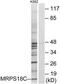 Mitochondrial Ribosomal Protein S18C antibody, TA315439, Origene, Western Blot image 