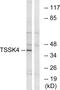 Testis Specific Serine Kinase 4 antibody, GTX87154, GeneTex, Western Blot image 