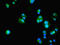 Hypoxia Inducible Factor 1 Subunit Alpha Inhibitor antibody, LS-C379424, Lifespan Biosciences, Immunofluorescence image 