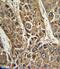 Microsomal Triglyceride Transfer Protein antibody, GTX80580, GeneTex, Immunohistochemistry paraffin image 