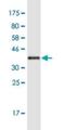 Kinesin Family Member 17 antibody, H00057576-M04-100ug, Novus Biologicals, Western Blot image 